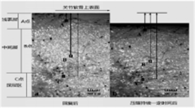 DIC应变视觉测量技术应用于知名学府骨科材料力学科研1184.png