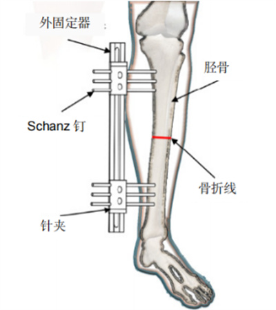 DIC应变视觉测量技术应用于知名学府骨科材料力学科研763.jpg