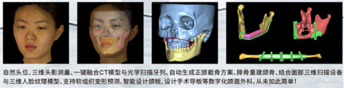 相约美容与整形学术年会｜准确重建面部三维数据，3D面部扫描技术助力医美整形1338.jpg