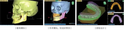 相约美容与整形学术年会｜准确重建面部三维数据，3D面部扫描技术助力医美整形1556.jpg