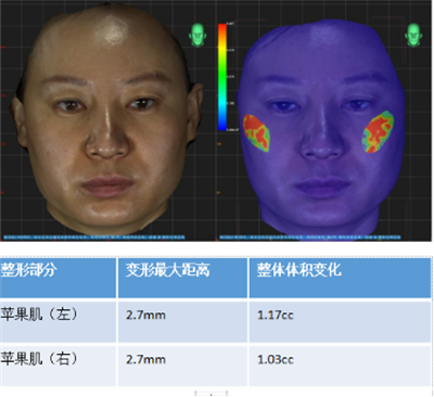 领智三维3D数字化轻医美  2023上海整形科技周精彩回顾1288.png